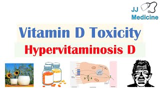 Vitamin D Toxicity Hypervitaminosis D  Causes Pathophysiology Symptoms Diagnosis Treatment [upl. by Nereen625]