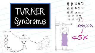 What is Turner Syndrome HealthSketch [upl. by Isaak623]