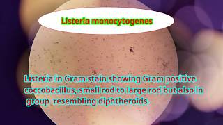 Listeria monocytogenes under microscope [upl. by Ria]