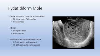 Gestational Trophoblastic Disease GTD [upl. by Yemorej]