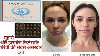 PROGYNOVAEstradiol2mg Tabletमुंहासे और हारमोंस रिप्लेसमेंट थेरेपी की सबसे असरदार दवा Full Review [upl. by Krakow]