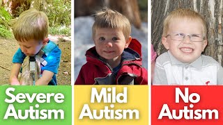 Signs of Mild Autism Severe Autism No Autism  Compared [upl. by Petronia]