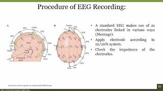 Fundamentals of EEG Signal [upl. by Inoliel]