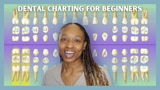 How To Read Xrays amp Hard Chart Using Dentrix  BEGINNER FRIENDLY [upl. by Elsey774]