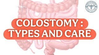 COLOSTOMY CARE [upl. by Desberg890]