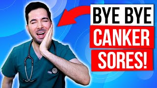 How to get rid of canker sores inside your mouth fast and treatment [upl. by Ahsenal]