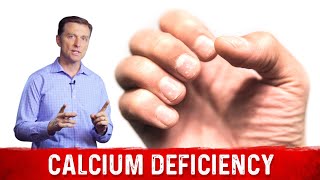 Causes amp Symptoms Of Calcium Deficiency – Dr Berg [upl. by Maybelle285]