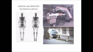 radioisotopes technetium 99m [upl. by Amles]