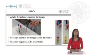 IMVIC Indol Rojo de metilo VogesProskauer Citrato   UPV [upl. by Avery]