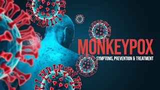 Monkeypox What You NEED To Know [upl. by Sekoorb493]