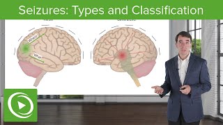 Seizures Types and Classification  Clinical Neurology [upl. by Naitsirk723]