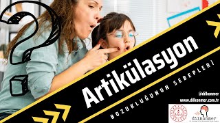 Artikülasyon Bozukluğunun Sebepleri [upl. by Furnary716]