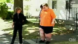 800 lb Man Loses 330 lbs in One Year [upl. by Barram943]