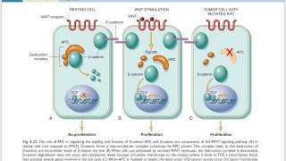 WNT signaling pathwayAPC geneAdenomatous polyposis coli Robbins pathology [upl. by Akimahc]