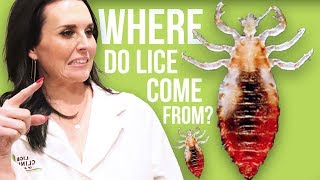 10 Facts You Dont Want to Know about Head Lice [upl. by Aissila139]