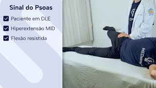 Sinal do Psoas  EXAME ABDOMINAL [upl. by Atirb]