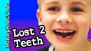 HobbyFrog LOST FIRST 2 TEETH His First Teeth Gone  Story How He Lost Them HobbyKidsVids [upl. by Hainahpez487]