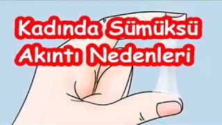 Kadında Sümüksü Akıntı Nedenleri [upl. by Haisoj70]