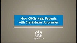 How OMSs Help Patients with Craniofacial Anomalies [upl. by Aschim921]