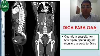 Angiotomografia de aorta COMO FAZER A AQUISIÇÃO [upl. by Notgnilliw433]