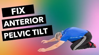 Fix Anterior Pelvic Tilt 4 Critical Exercises [upl. by Bainbridge]