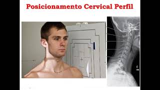 Protocolos AP e Perfil da Coluna Cervical [upl. by Nemracledairam]