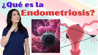 ¿Qué es la endometriosis y cómo se maneja [upl. by Agee]