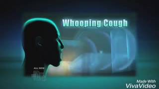 Different types of cough sounds [upl. by Cloris202]