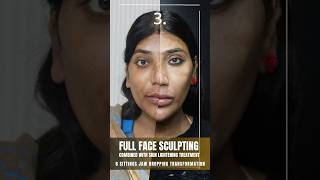 Full Face Sculpting amp Depigmentation at Sarayu Clinics beauty skincare [upl. by Christis]