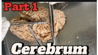 Gyri and sulci of cerebrum part 1 mbbsanatomy nepalforyou viral medicalhacks [upl. by Todd]