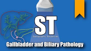 Gallbladder and Biliary Pathology [upl. by Aisayn]