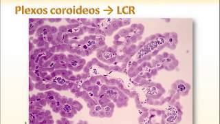 13 LCR y Plexos coroideos [upl. by Doria]