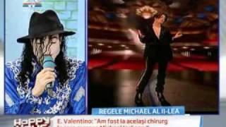 Earnest Valentino Am fost la acelasi chirurg la care mergea Michael Jacksonflv [upl. by Nathaniel]