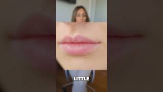 Lip Flip vs Lip Filler Whats the difference [upl. by Salamanca]