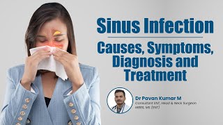 Sinus Infection Causes Symptoms Diagnosis amp Treatment  Medicover Hospitals [upl. by Demmahum]