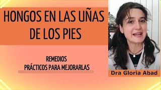 HONGOS EN LA UÑAS UÑAS DE PIE TRATAMIENTO Y PREVENIR 📌  TIPS para MEJORAR uñas CASERO 📌 [upl. by Pfosi]