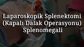 Laparoskopik Splenektomi Kapalı Dalak Operasyonu Splenomegali [upl. by Brittni632]