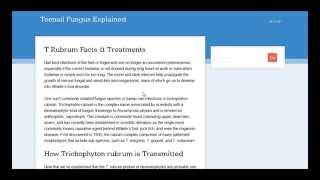 Trichophyton Rubrum Nail Fungus Treatment [upl. by Evander546]