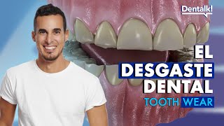 ¿DIENTES DESGASTADOS  Causa y TRATAMIENTO de abfracción atrición y otros desgastes  Dentalk © [upl. by Enasus]