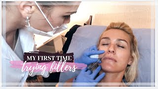 My First Time Trying Fillers Before amp After Photos [upl. by Akerdna338]