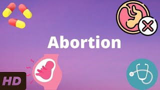 Abortion Everything You Need To Know [upl. by Jehiel]