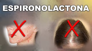 ESPIRONOLACTONA ¿solución ACNÉ y ALOPECIA femenina [upl. by Davina]