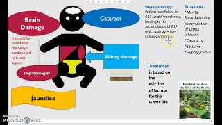 What is Galactosemia Causes Diagnosis Treatment Classic vs Galactokinase Deficiency USMLE NCLEX 3 M [upl. by Anifesoj]