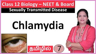 Chlamydia  Reproductive Health NCERT Class 12 biology [upl. by Acireh]