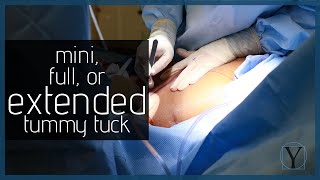 Mini Full or Extended Tummy Tuck  Y Plastic Surgery [upl. by Modeerf6]