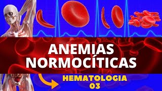 ANEMIAS NORMOCÍTICAS ANEMIAS  HEMATOLOGIA [upl. by Yllib]