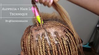 NEW TECHNIQUE ALOPECIA  HAIR LOSS BOX BRAIDS  IRENESBRAIDS [upl. by Htnamas]