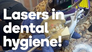 Four ways a dental hygienist can use lasers [upl. by Bolt]