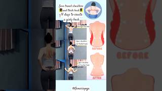 3 Actions For Women To Lose Back Fat and Fix Humpback and Rounded Shoulder backworkout womenfitnes [upl. by Ydiarf]