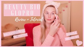 BEAUTY BIO GLOPRO Review  Tutorial  Painful Worth It [upl. by Assertal]